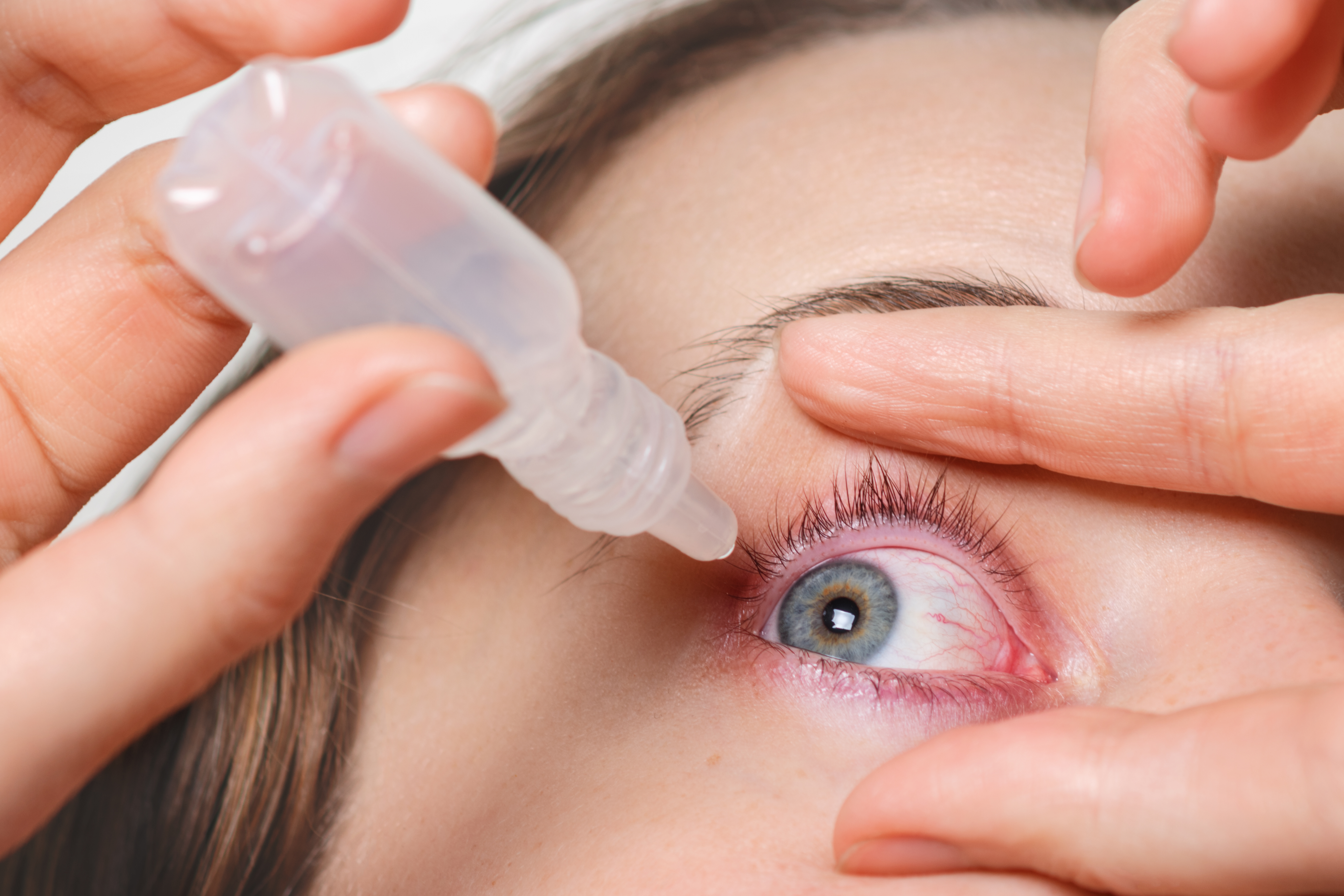 Vitreo Retinal Surgery